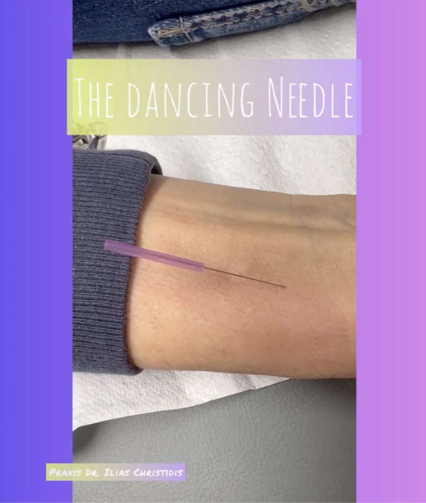 The dancing needle